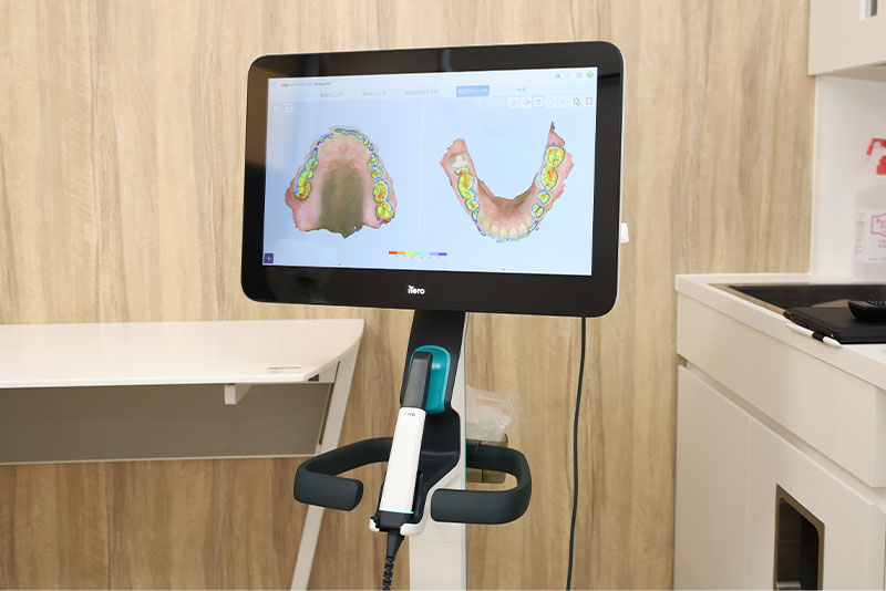 設備紹介05_口腔内スキャナー