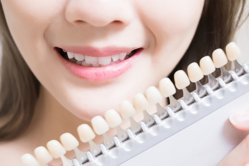 診療案内11_ホワイトニング